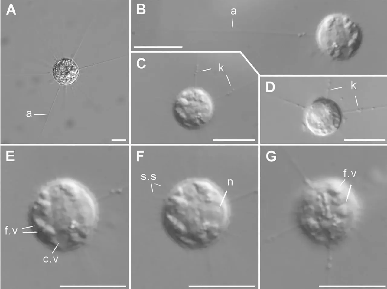 Учёные в 2026 году извлекли из мерзлоты живой ранее неизвестный протист Acanthocystis yamallongha. Организм относится к центрохелидам и питается бактериями и другими микроорганизмами. Какие риски и открытия ждут исследователей — в материале.